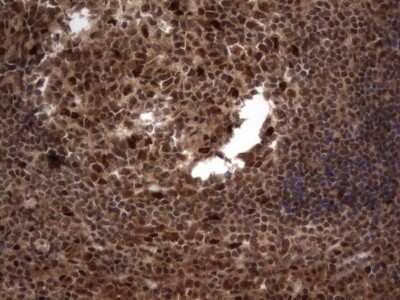 Immunohistochemistry: Macro H2A.2 Antibody (OTI1C2) [NBP2-45930]