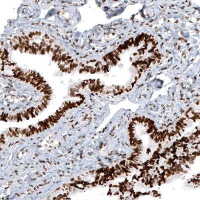 Immunohistochemistry: Macro H2A.2 Antibody (CL5263) [NBP2-61156]