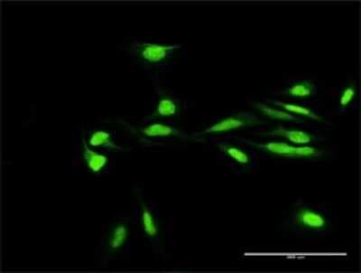 Immunocytochemistry/ Immunofluorescence: Macro H2A.2 Antibody [H00055506-D01P]