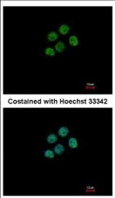 Immunocytochemistry/ Immunofluorescence: Macro H2A.2 Antibody [NBP2-17197]