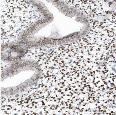 Immunohistochemistry-Paraffin: Macro H2A.2 Antibody [NBP1-92094]