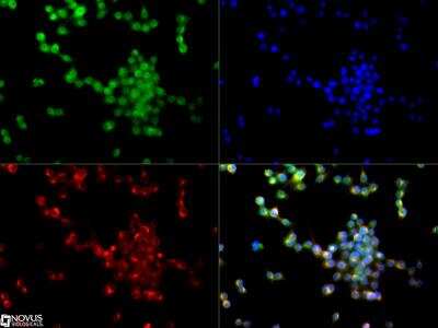 Immunocytochemistry/ Immunofluorescence: SR-AI/MSR Antibody [NB400-159]