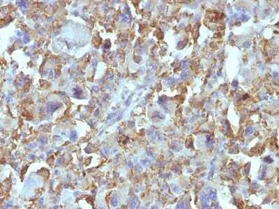 Immunohistochemistry-Paraffin: Macrophage and Histiocytoma Marker Antibody (D11) [NBP2-45278]