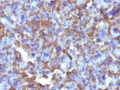 Immunohistochemistry-Paraffin: Macrophage and Histiocytoma Marker Antibody (D11) [NBP2-45278]