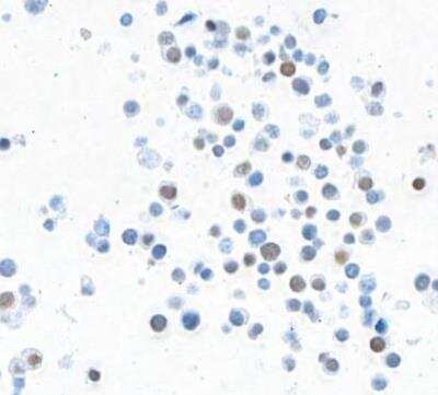 Immunocytochemistry/ Immunofluorescence: MafA Antibody (BLR067G) [NBP2-78707]