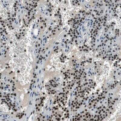 Immunohistochemistry-Paraffin: MafB Antibody [NBP1-81342]