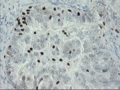 Immunohistochemistry: MafB Antibody (OTI1E9) [NBP2-45718]