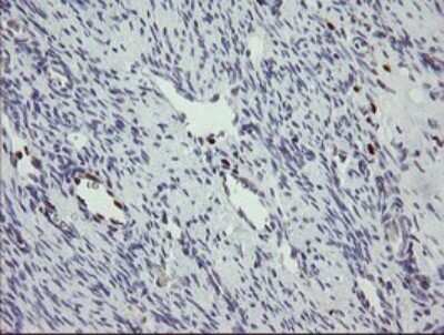Immunohistochemistry: MafB Antibody (OTI1E9) [NBP2-45718]