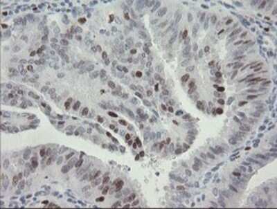 Immunohistochemistry: MafB Antibody (OTI1E9) [NBP2-45718]