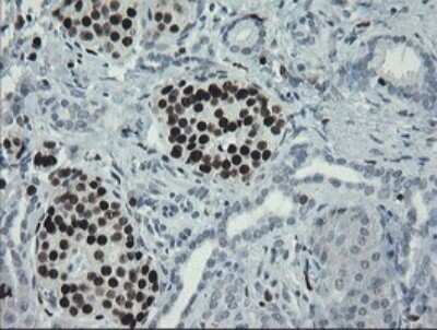 Immunohistochemistry: MafB Antibody (OTI1E9) [NBP2-45718]