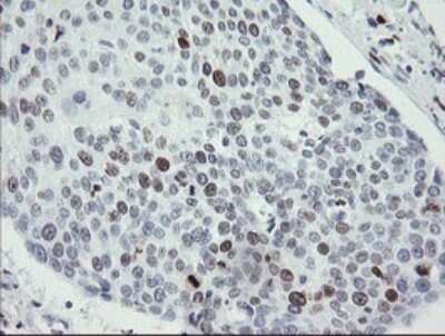 Immunohistochemistry: MafB Antibody (OTI1E9) [NBP2-45718]