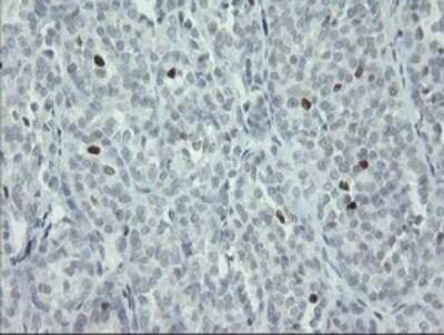 Immunohistochemistry: MafB Antibody (OTI1E9) [NBP2-45718]