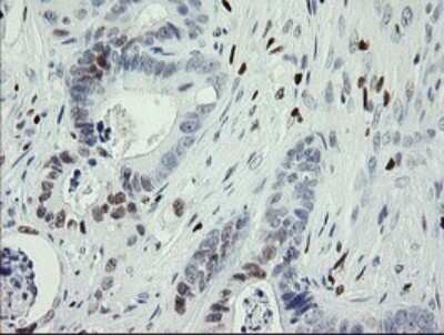 Immunohistochemistry: MafB Antibody (OTI1E9) [NBP2-45718]
