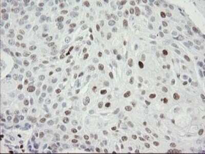 Immunohistochemistry: MafB Antibody (OTI1E9) [NBP2-45718]