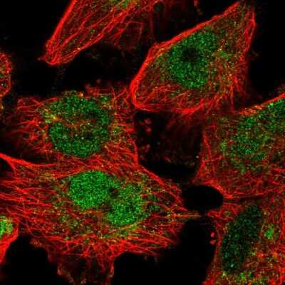 Immunocytochemistry/ Immunofluorescence: MafF Antibody [NBP2-56792]