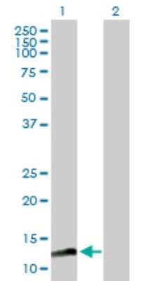 Western Blot: Mago nashi homolog 2 Antibody [H00055110-B01P]
