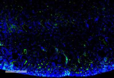 Immunohistochemistry: Malondialdehyde Antibody (11E3) [NBP2-59367]