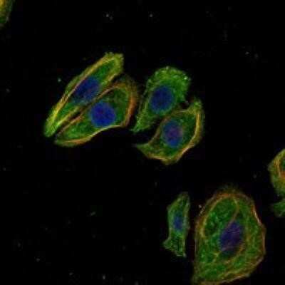 Immunocytochemistry/ Immunofluorescence: Mammaglobin A Antibody (3C8) - BSA Free [NBP1-51671]