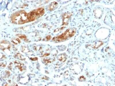 Immunohistochemistry-Paraffin: Mammaglobin A Antibody (MGB/2000) [NBP2-75728]