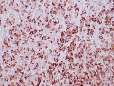 Immunohistochemistry-Paraffin: Mammaglobin A Antibody (MGB/2000) [NBP2-75728]