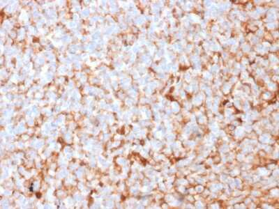 Immunohistochemistry-Paraffin: Mammaglobin A Antibody (MGB/2682R) [NBP3-07305]