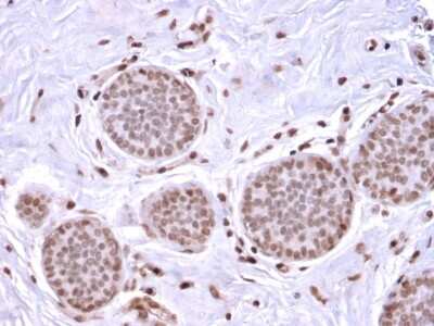 Immunohistochemistry-Paraffin: Mammaglobin A Antibody (MGB/2682R) [NBP3-07305]
