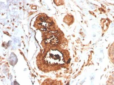 Immunohistochemistry-Paraffin: Mammaglobin A Antibody (MGB/4058R) - Azide and BSA Free [NBP3-08586]