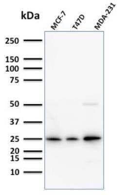 Western Blot: Mammaglobin A Antibody (SPM518)Azide and BSA Free [NBP2-79864]