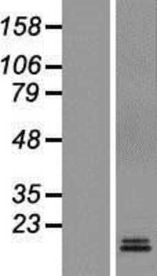 Western Blot: CD-M6PR Overexpression Lysate [NBP2-10825]