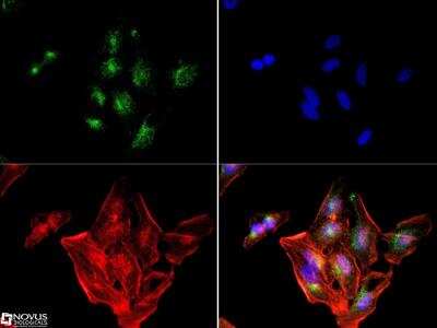 Immunocytochemistry/ Immunofluorescence: IGF-II R/IGF2R Antibody (2G11) - BSA Free [NB300-514]
