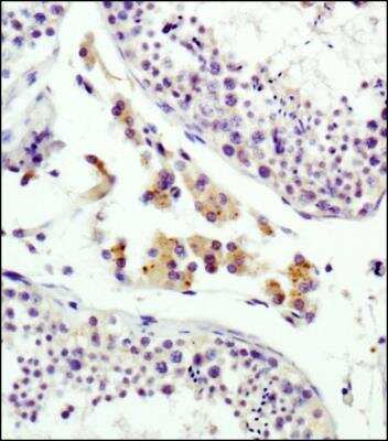 Immunohistochemistry: IGF-II R/IGF2R Antibody (2G11) - BSA Free [NB300-514]