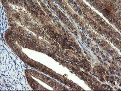 Immunohistochemistry-Paraffin: Mannose Phosphate Isomerase Antibody (OTI1C7) [NBP2-02043]