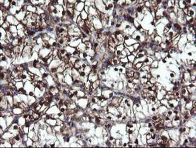 Immunohistochemistry-Paraffin: Mannose Phosphate Isomerase Antibody (OTI1C7) [NBP2-02043]