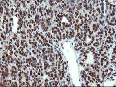 Immunohistochemistry-Paraffin: Mannose Phosphate Isomerase Antibody (OTI1C7) [NBP2-02043]