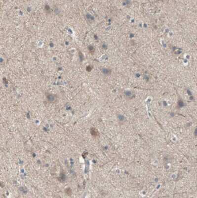 Immunohistochemistry-Paraffin: Mannose Phosphate Isomerase Antibody [NBP1-85787]