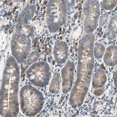 Immunohistochemistry-Paraffin: Mannose Phosphate Isomerase Antibody [NBP1-85787]