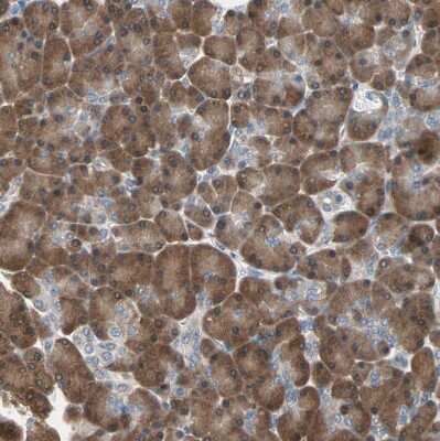 Immunohistochemistry-Paraffin: Mannose Phosphate Isomerase Antibody [NBP1-85787]