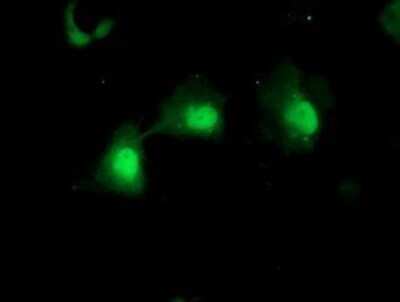 Immunocytochemistry/ Immunofluorescence: Mannose Phosphate Isomerase Antibody (OTI1C7) - Azide and BSA Free [NBP2-72582]