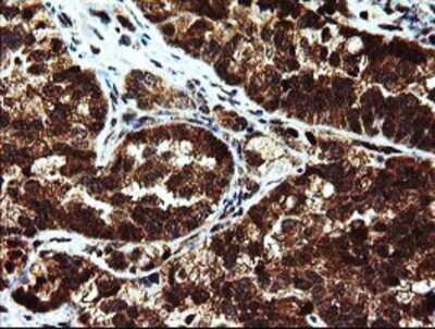 Immunohistochemistry: Mannose Phosphate Isomerase Antibody (OTI1C7) - Azide and BSA Free [NBP2-72582]