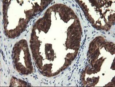 Immunohistochemistry: Mannose Phosphate Isomerase Antibody (OTI1C7) - Azide and BSA Free [NBP2-72582]
