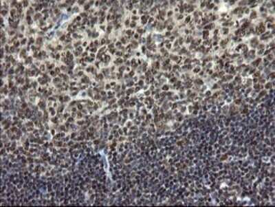 Immunohistochemistry: Mannose Phosphate Isomerase Antibody (OTI4G7) [NBP2-45834]