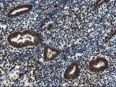 Immunohistochemistry: Mannose Phosphate Isomerase Antibody (OTI4G7) [NBP2-45834]