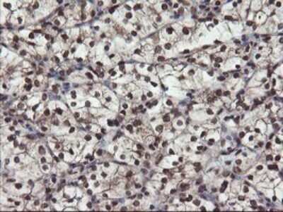 Immunohistochemistry: Mannose Phosphate Isomerase Antibody (OTI4G7) [NBP2-45834]