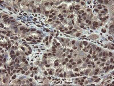 Immunohistochemistry: Mannose Phosphate Isomerase Antibody (OTI4G7) [NBP2-45834]