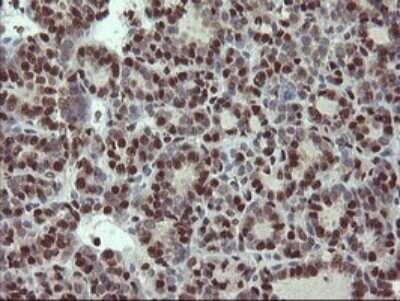 Immunohistochemistry: Mannose Phosphate Isomerase Antibody (OTI4G7) [NBP2-45834]