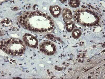 Immunohistochemistry: Mannose Phosphate Isomerase Antibody (OTI4G7) [NBP2-45834]