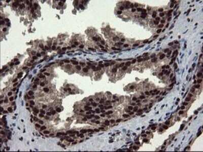 Immunohistochemistry: Mannose Phosphate Isomerase Antibody (OTI4G7) [NBP2-45834]