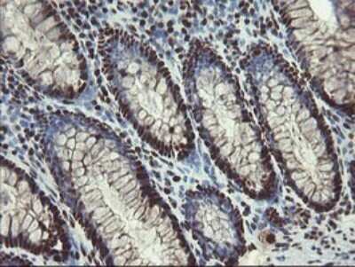 Immunohistochemistry: Mannose Phosphate Isomerase Antibody (OTI4G7) [NBP2-45834]