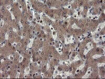 Immunohistochemistry: Mannose Phosphate Isomerase Antibody (OTI4G7) [NBP2-45834]