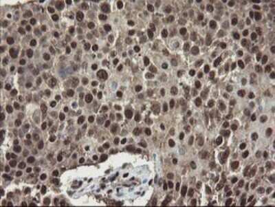 Immunohistochemistry: Mannose Phosphate Isomerase Antibody (OTI4G7) [NBP2-45834]